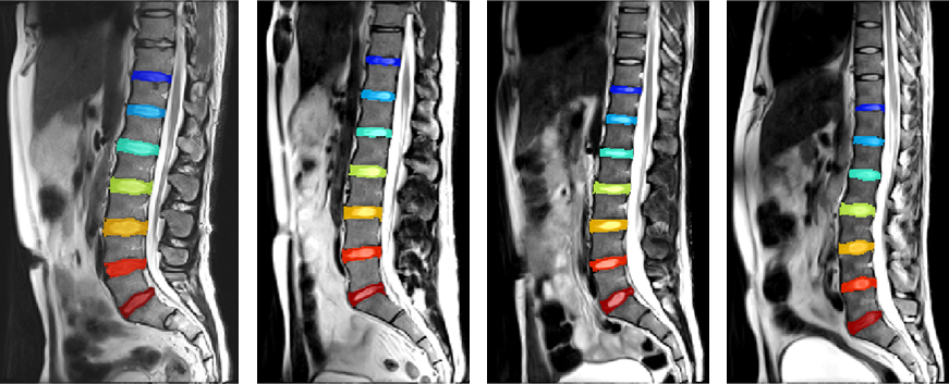 Imaging for Otolaryngologists/THIEME MEDICAL PUBL INC/Erwin A. Dunnebier