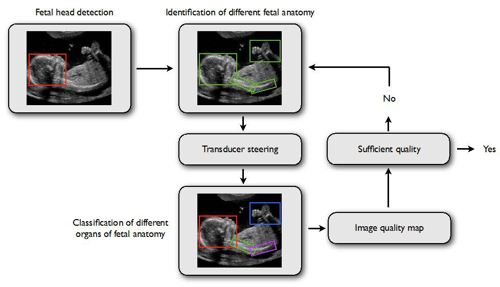 US Image Quality maps